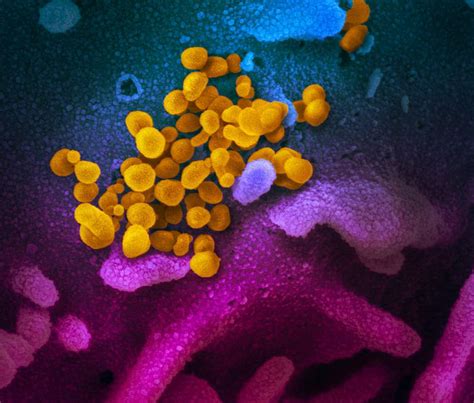 corona virus metal box|New coronavirus stable for hours on surfaces.